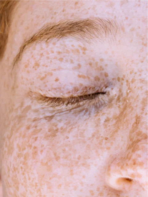 Dark Spot Routine Duo